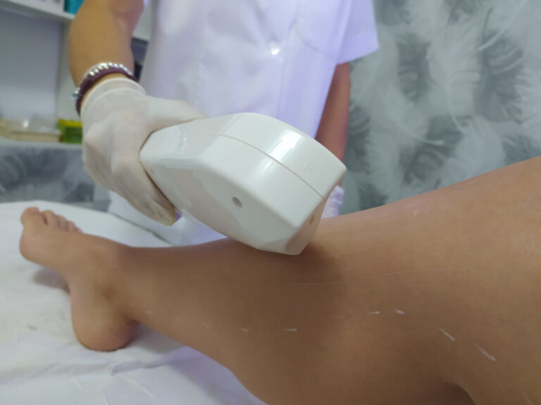 depilacion mia piernas 2 768x576